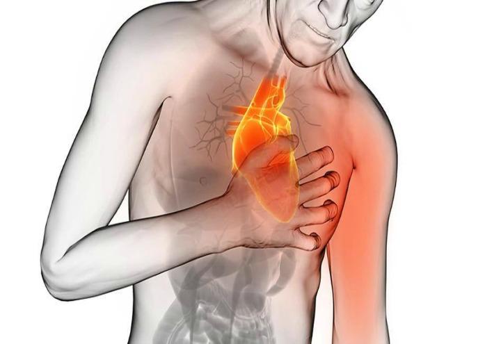 Infarto_cuore_web_2017