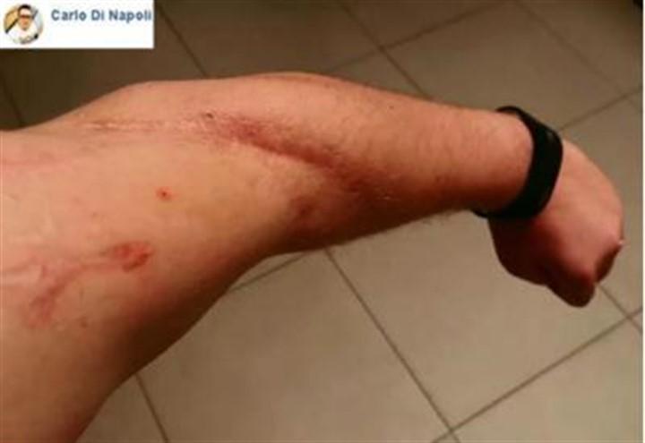 braccio_machete_carlo_di_napoli_facebook