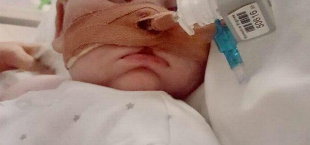 Charlie-Gard-eyes-fb