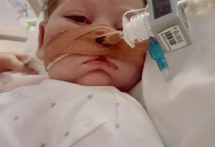 Charlie-Gard-eyes-fb