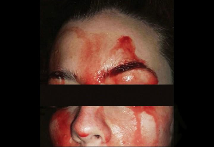 La_ragazza_che_suda_sangue_dagli_occhi
