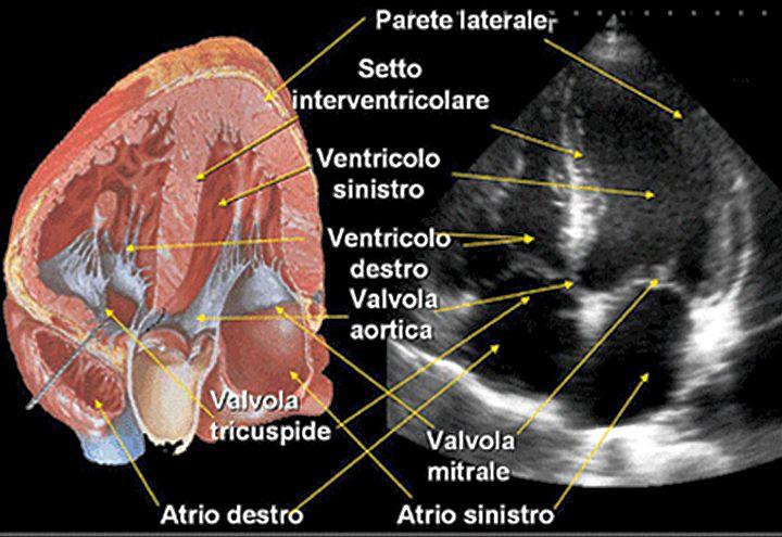 Minoli_65_00_apertura-cuore2-ecocardiogramma_720x495_ok