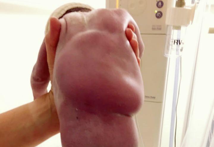 bimbo_ventosa_madre_utero_rottura_WEB_2017