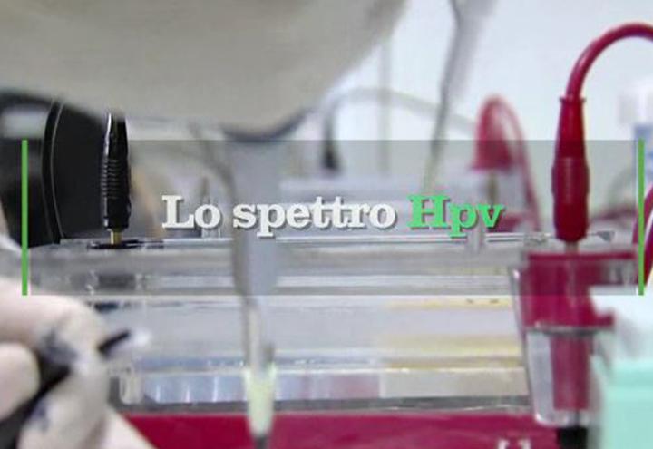 hpv_2017