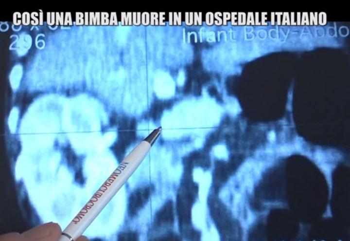 invaginazione_iene