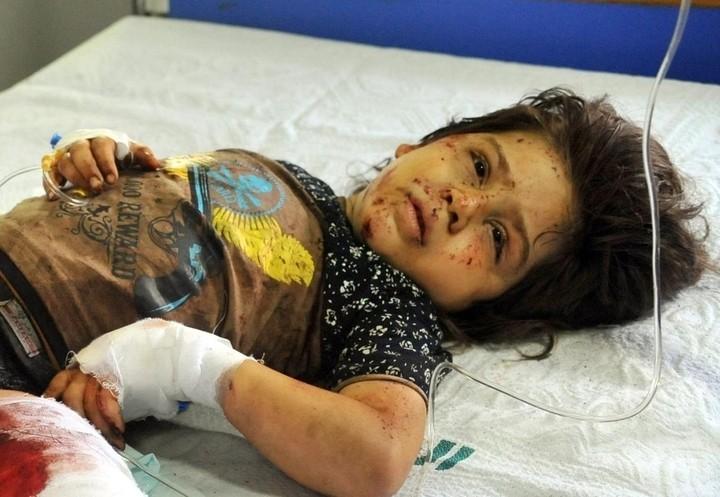 siria_guerra_7_bambina_attentato_lapresse_2017