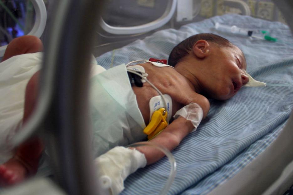neonato_intubato.jpg
