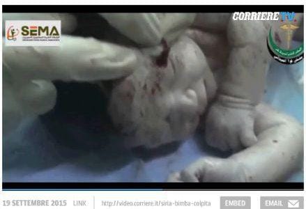 siria_neonato_interventoR439