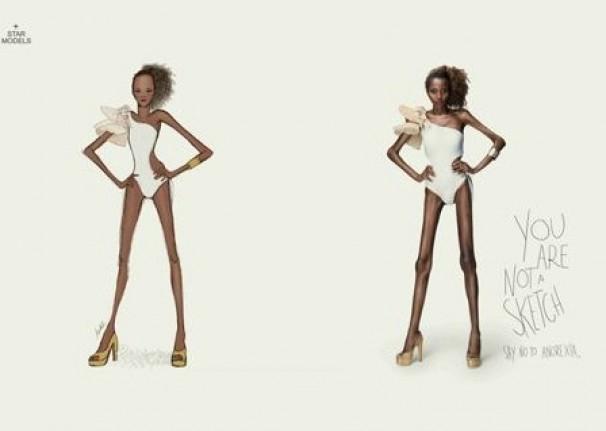 anoressia