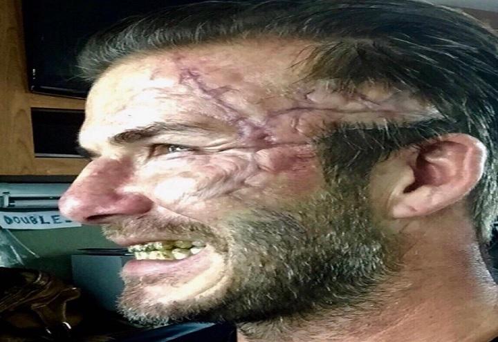 david_beckham_cicatrice_instagram