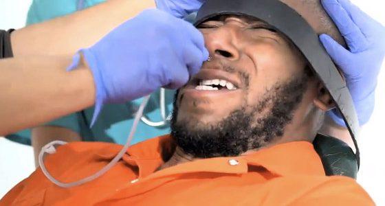 mos-def-alimtazione-forzata