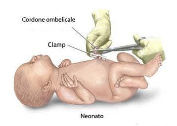 cordoneombelicale_R375
