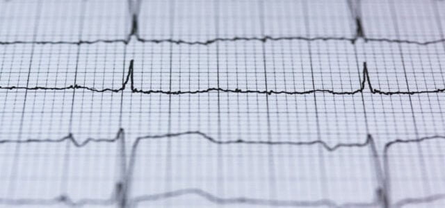 ecg elettrocardiogramma pixabay 640x300