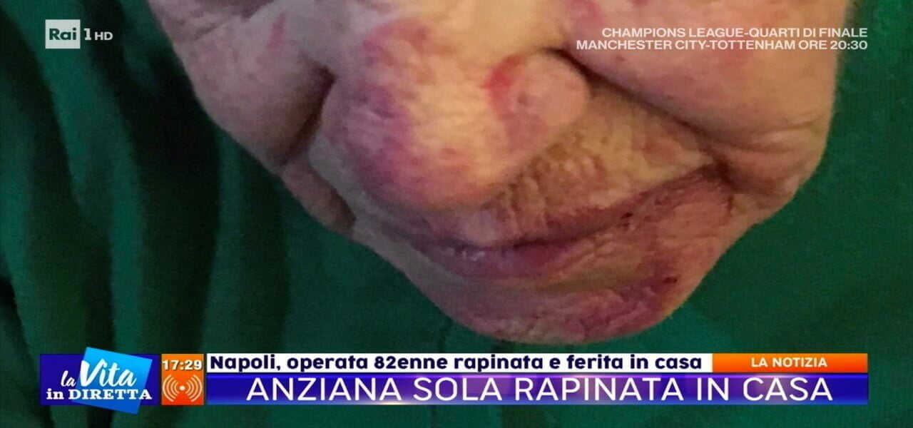 anziana rapinata napoli vita diretta