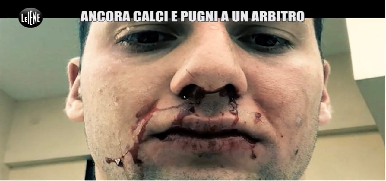 arbitro picchiato cardito iene