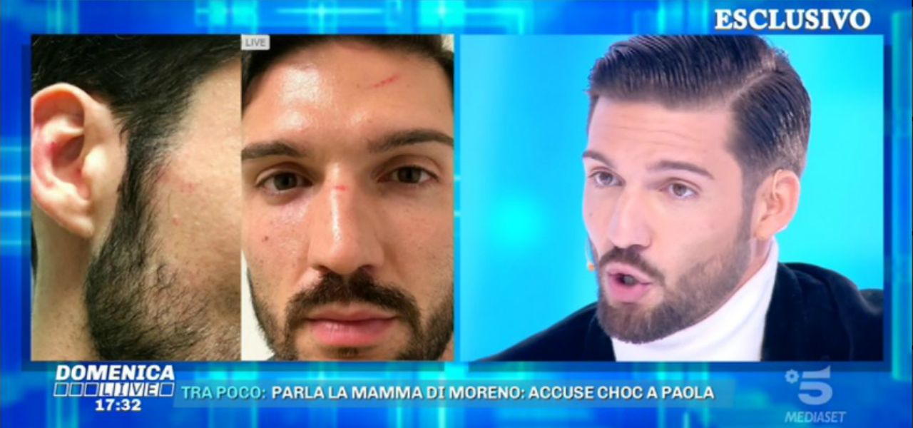 moreno merlo domenica live