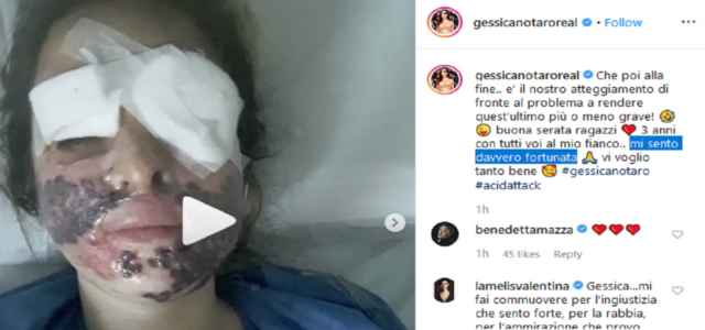 Gessica Notaro, video dopo intervento del 2017/ "Mi sento ...