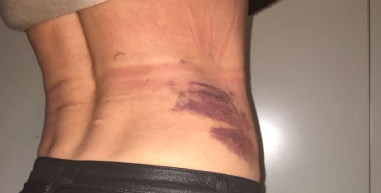 nina moric lividi instagram