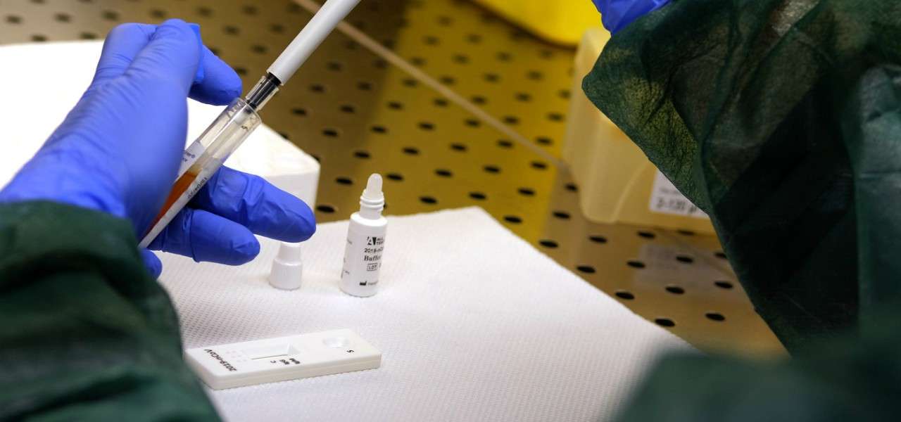 Coronavirus nato in laboratorio a Wuhan giuseppe tritto