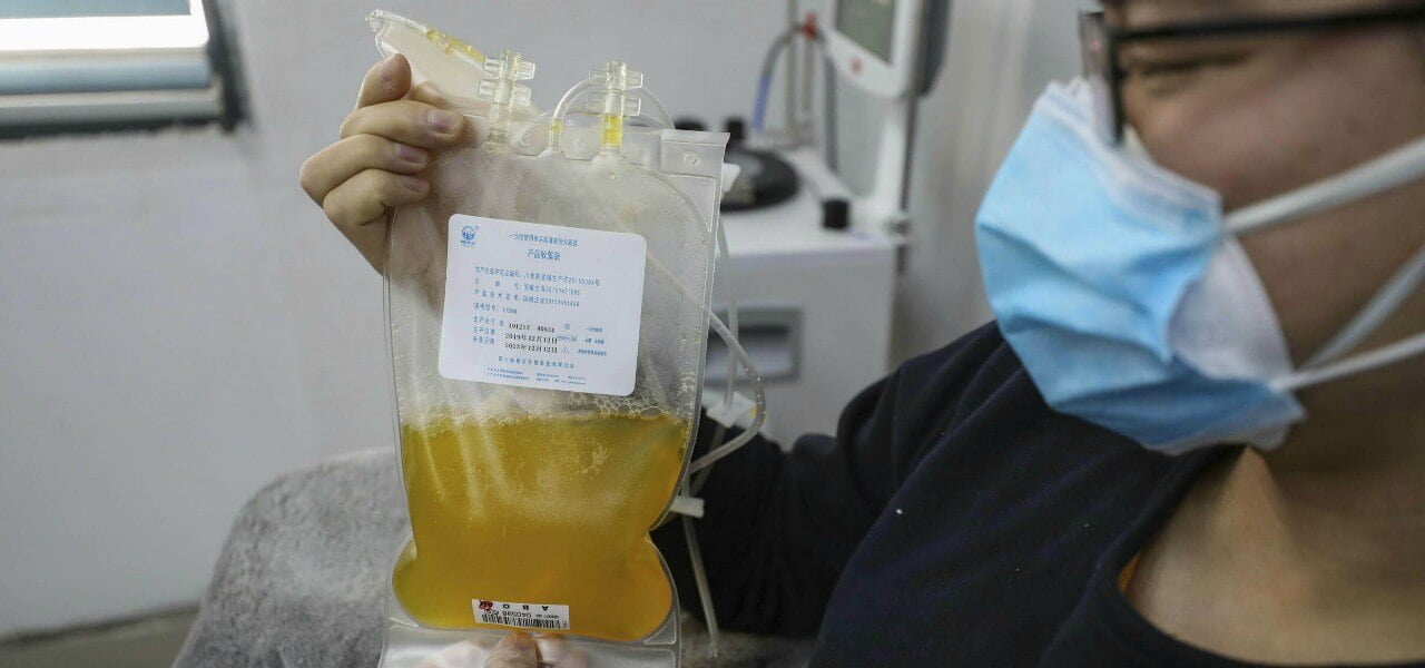 Plasma iperimmune