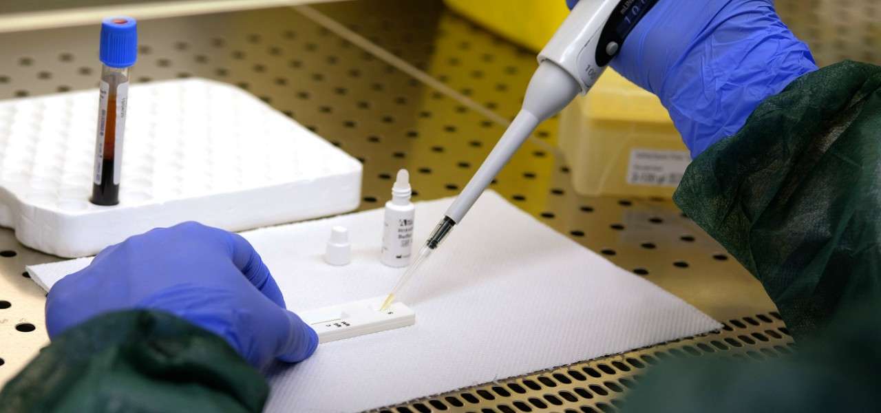 Coronavirus guarite positive