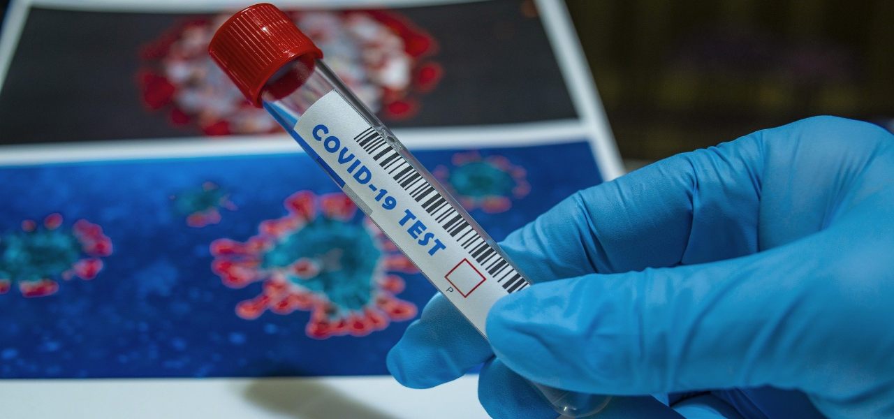 Test Coronavirus