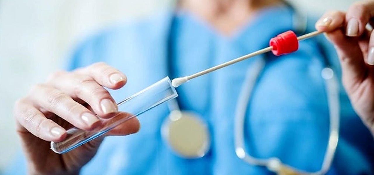 Tamponi, i test virologici